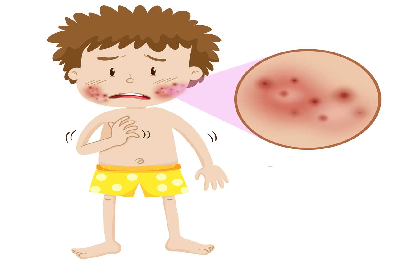 Hướng dẫn chọn sữa rửa mặt cho da mụn