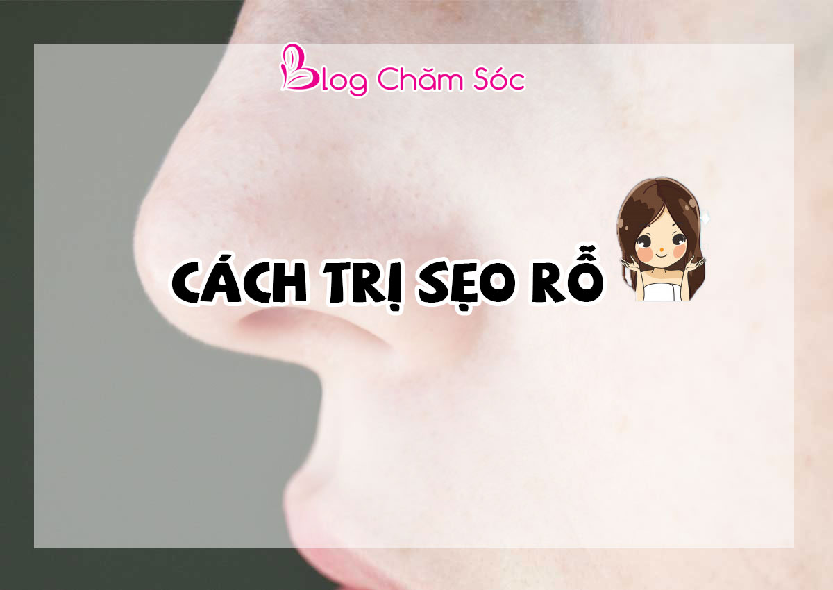 Cách trị sẹo rỗ hiệu quả, an toàn và nhanh chóng cho da