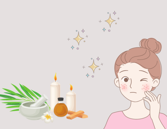 3 Cảnh báo nguy cơ tự dùng Klenzit C trị mụn tại nhà